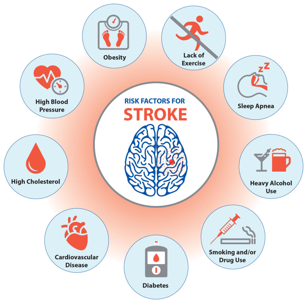 Eat right to keep that stroke away – Cardiac Wellness Institute